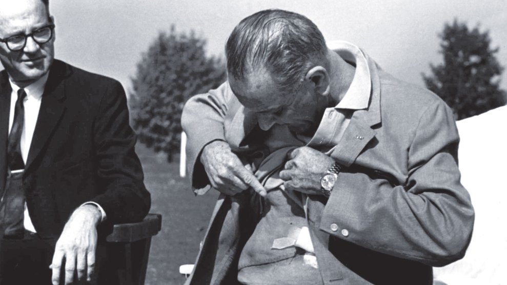 U.S. President Lyndon Baines Johnson displays the incision from his gall bladder surgery and kidney stone removal at a news conference at Bethesda Naval Hospital in Washington Oct. 20, 1965.