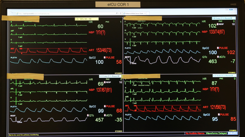 Patients’ vital signs on a monitor.