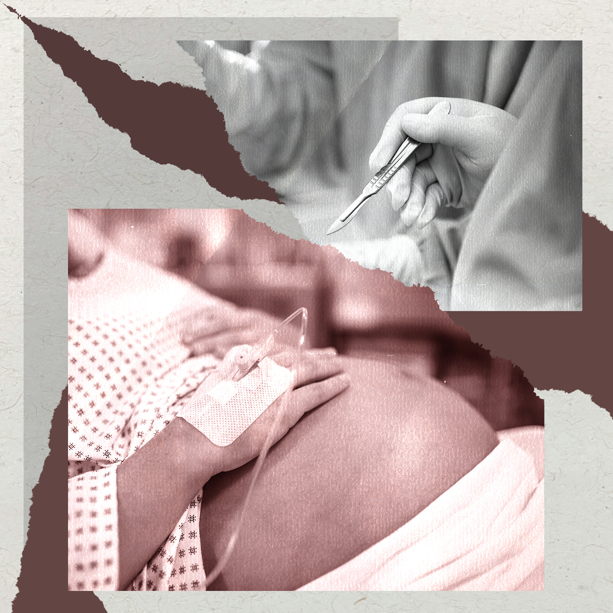 A collage shows images of a pregnant person in a hospital gown holding their belly and a doctor holding a scalpel.