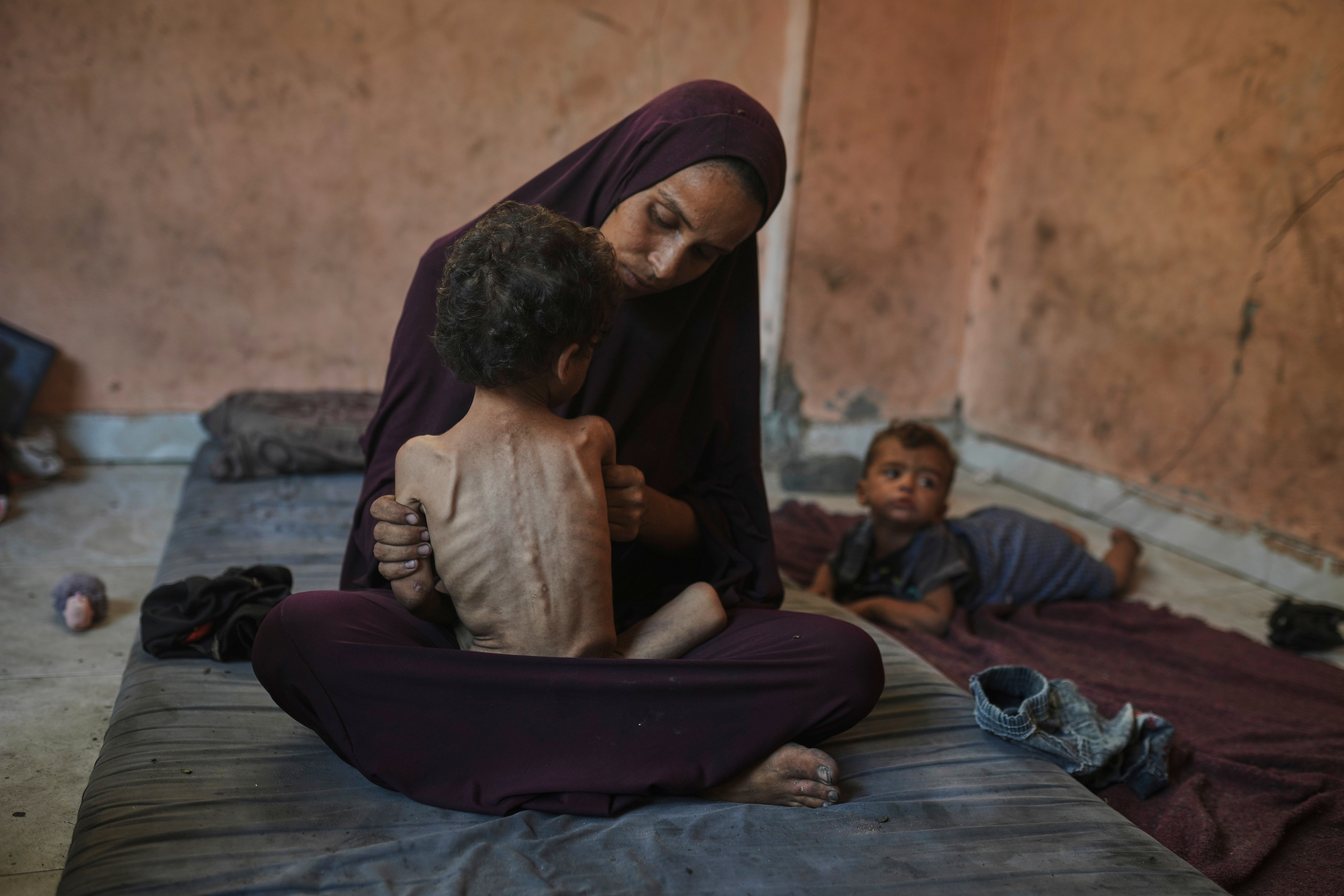A woman in a hijab sits on the floor, holding her emaciated child, who is skeletal and malnourished. 