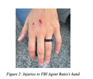 Close-up of hand with two small abrasions on the top.